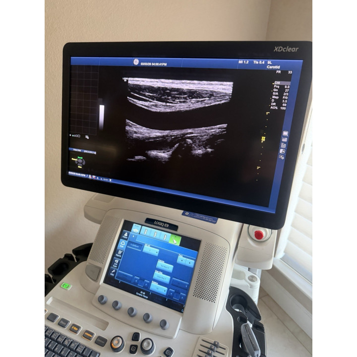 GE HealthCare LOGIQ E9 Ultrasound System Sale